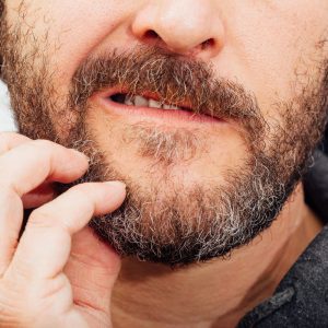 Schuppen im Bart – Wie du sie erkennst und wieder los wirst