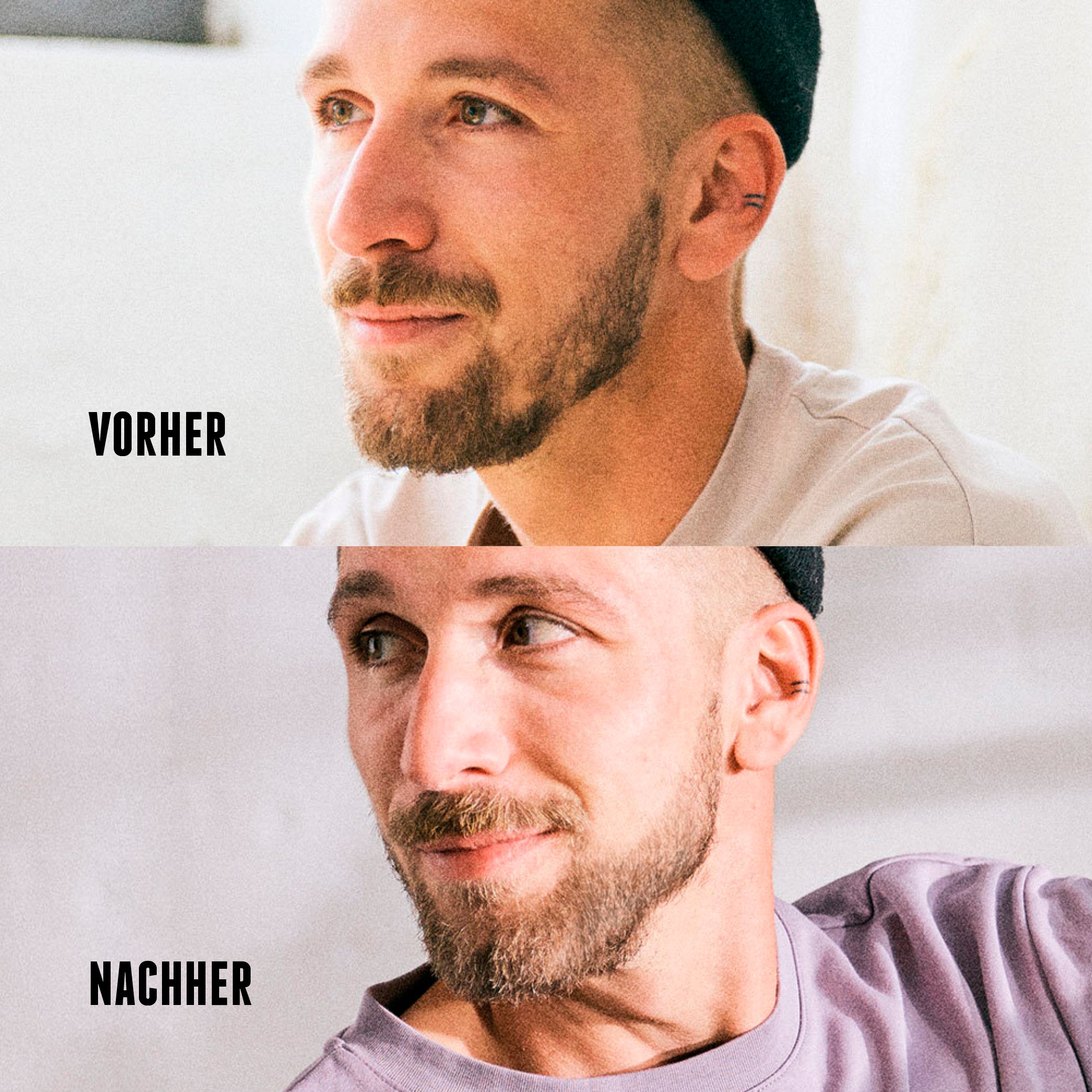 Der Vorher-Nachher-Effekt zeigt die Wirkung des Activator Bartshampoos von der Brooklyn Soap Company mit sichtbar gepflegterem, vollerem Bart nach regelmäßiger Anwendung