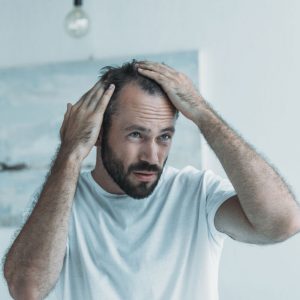 Haarausfall bei Männer – Ursachen & Tipps