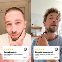 Kunden loben das gute Ergebnis und die einfache Anwendung des Activator Beard Bundles für mehr Bartwachstum. 